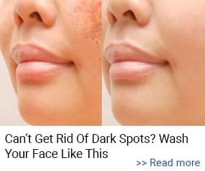 before and after dark spots on face